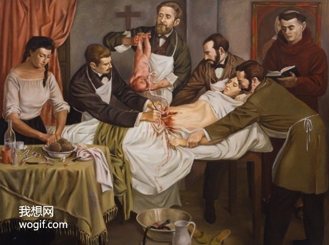 第一次剖腹產(chǎn)手術，來自1500年瑞士的“豬閹割師”完成（圖）